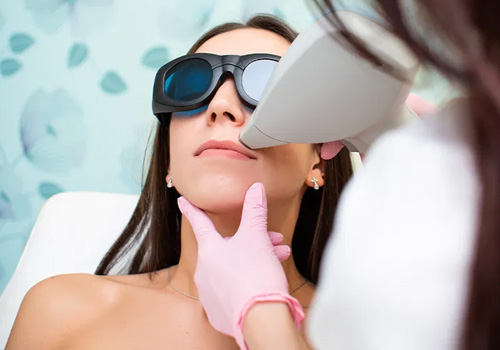 Laser Hair Removal