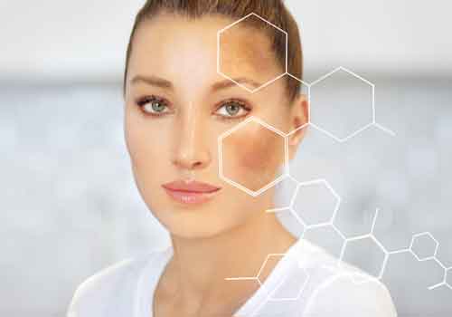 Pigmentation & Melasma